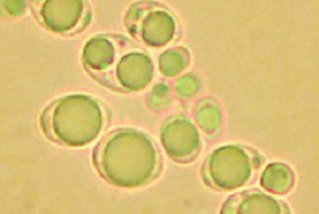 Bioraffinerie et biologie de synthèse